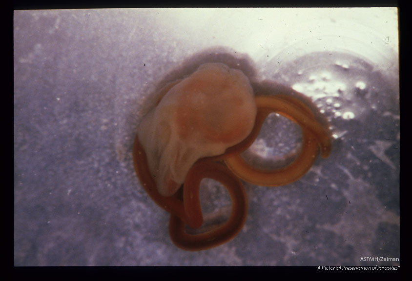 Fourth stage larva emerging from a cyst commonly found in the abdominal cavity of bull minnows. Fundulus heteroclitus. Human infections have been reported.