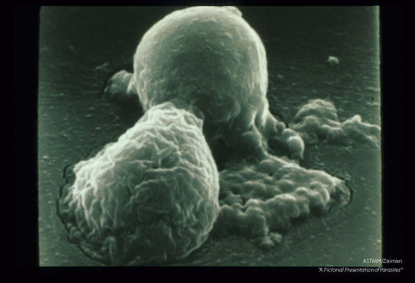 Photograph made with a scanning electron microscope.