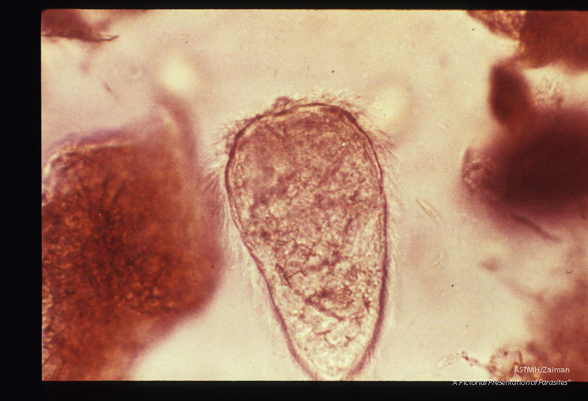 Miracidium.