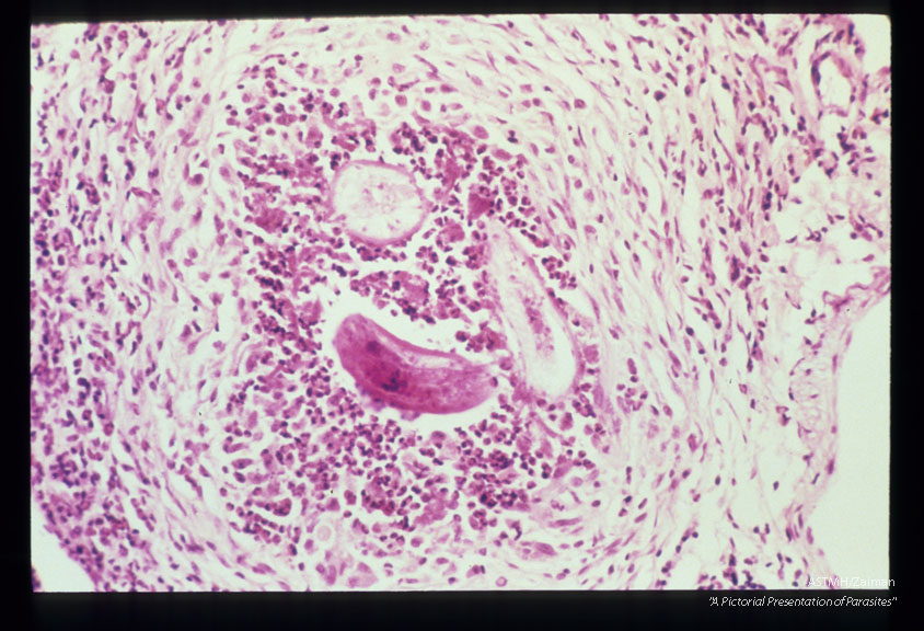 Pulmonary granuloma in a naturally infected woodchuck.