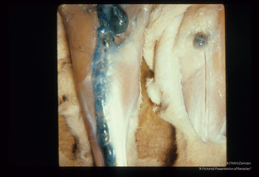 Lymphangiogram in an experimentally infected cat demonstrates the thickening and dilation caused by the filaria. Lymphatics demonstrated with sky blue dye.