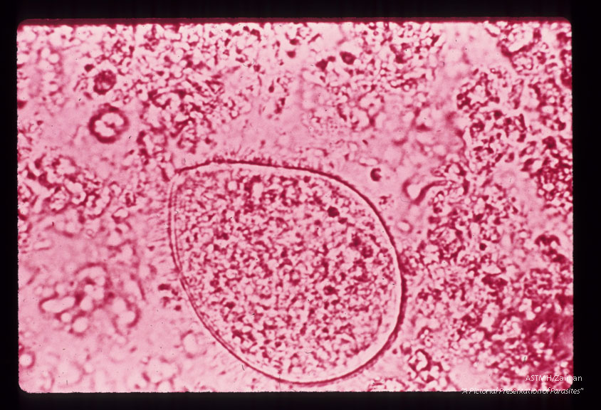 Trophozoite in stool.