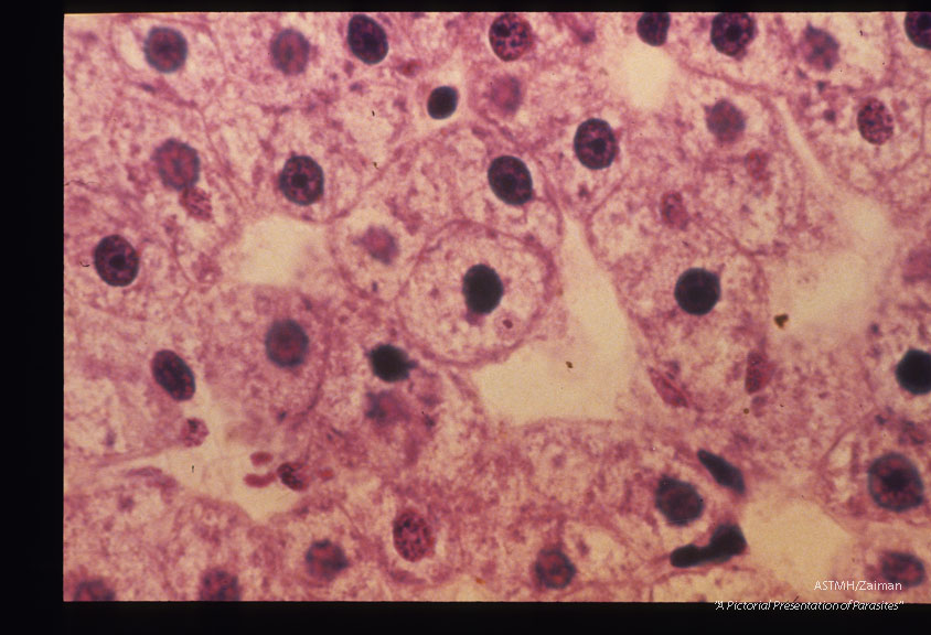 Demonstration of hypnozoiite and hepatic schizonts by immunof lucres cent antibodies and subsequent counterstaining by Giemaa-colophonium.