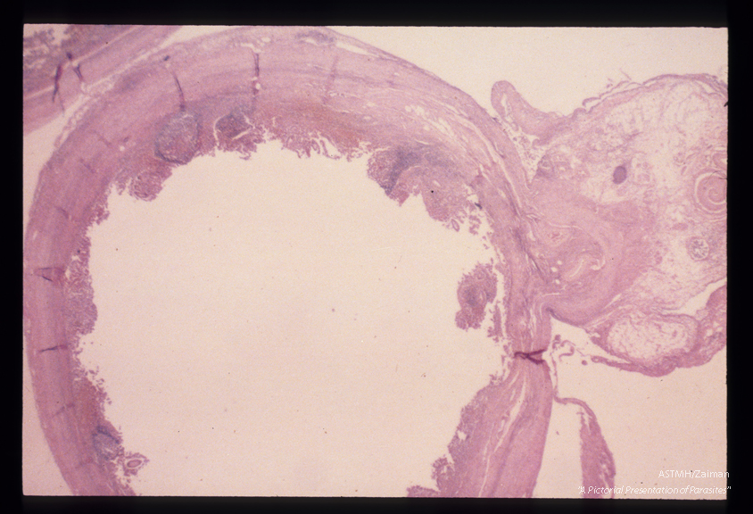 Adult male in the mesoappendiceal vein. The parasite is seen as a coiled object in the upper right hand corner. No ova were seen in the appendix itself.