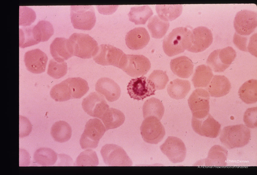 Growing trophozoites.