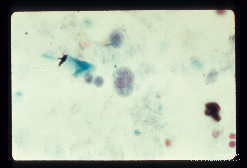 Parasite in center is a cyst with at least four nuclei.
