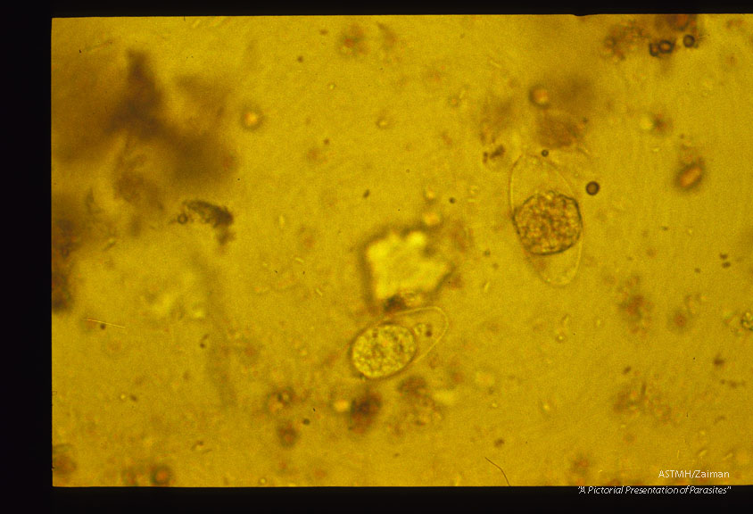 Oocysts, iodine stained and unstained in stool