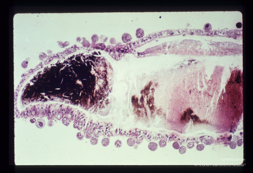 Oocysts on wall of mosquito stomach. The spherical objects peripheral to the stomach wall are the oocysts within which sporozoites are formed.