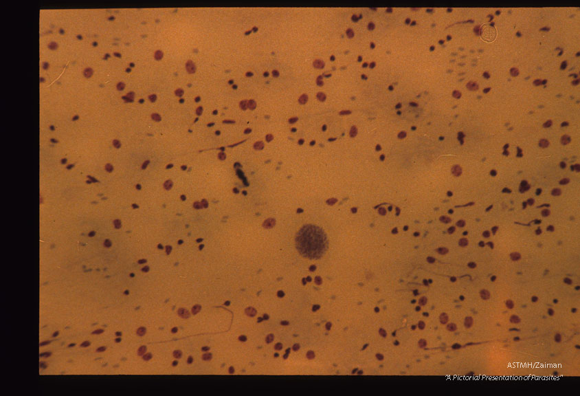 Giemsa stained mouse brain squash. Low and high magnifications.