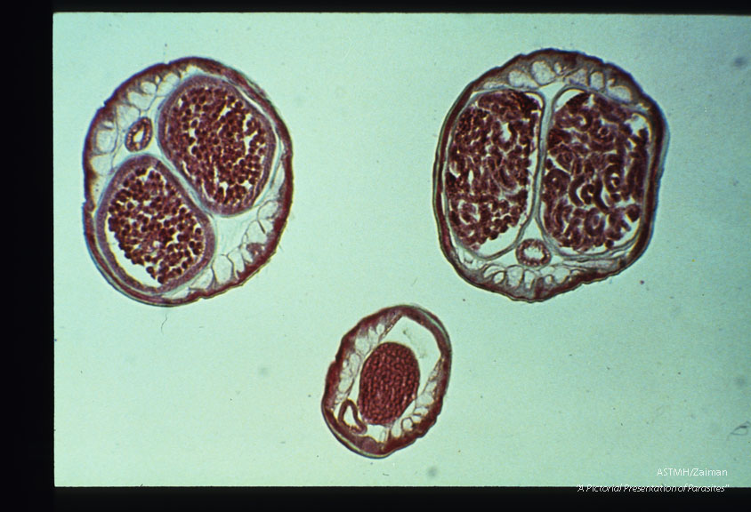 Cross section through adult male and female worms.