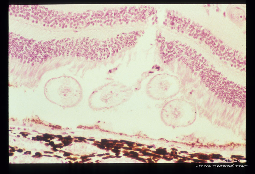 Subretinal larva and outer nuclear layer pyknosis in an experimentally infected cynomolgus monkey.