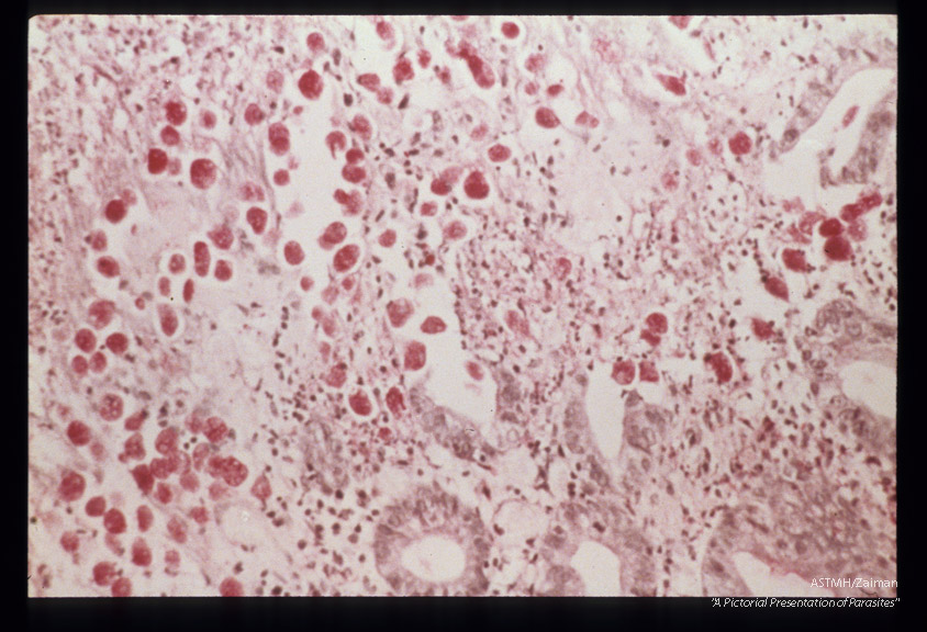 Best carmine stained section of rectum.