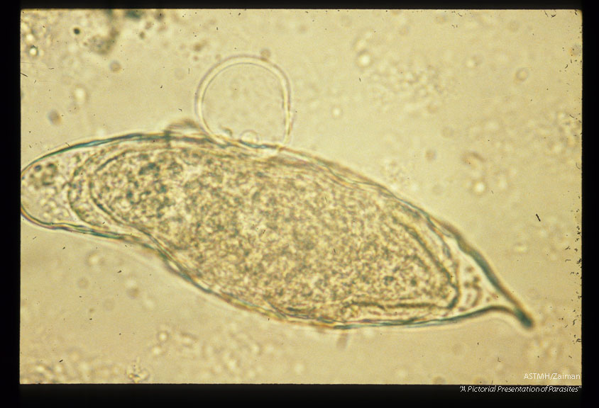 Egg with circumoval precipitate.