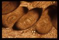 Various magnifications of calcified cysts in masseter muscle of rat xeroradiographed in slide 1602.