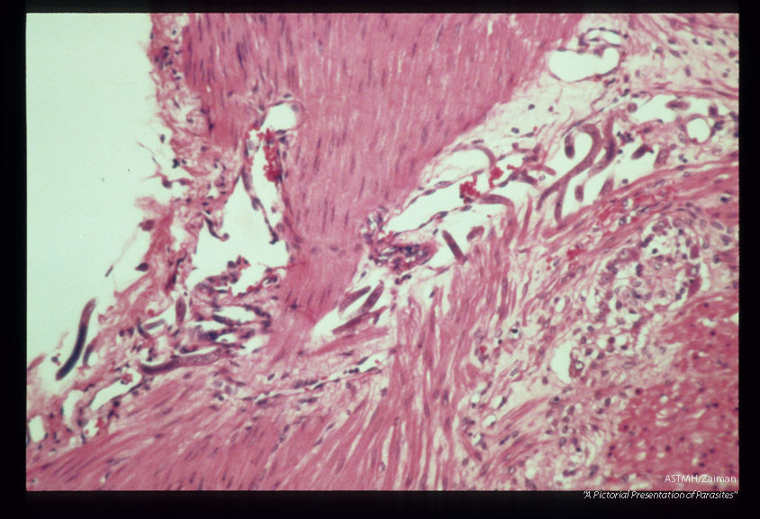 Larval migration through colonic wall during experimental infection of Erythrocebus pata.