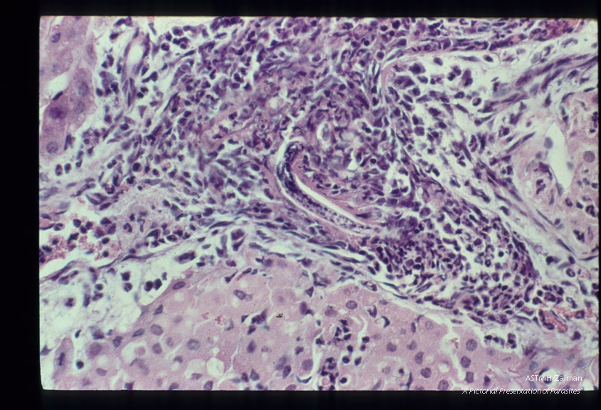 Second stage larva in liver of immune guinea pig.