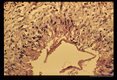 Gross and microscopic photos of human liver from Minnesota where about one half of the red foxes are infected.