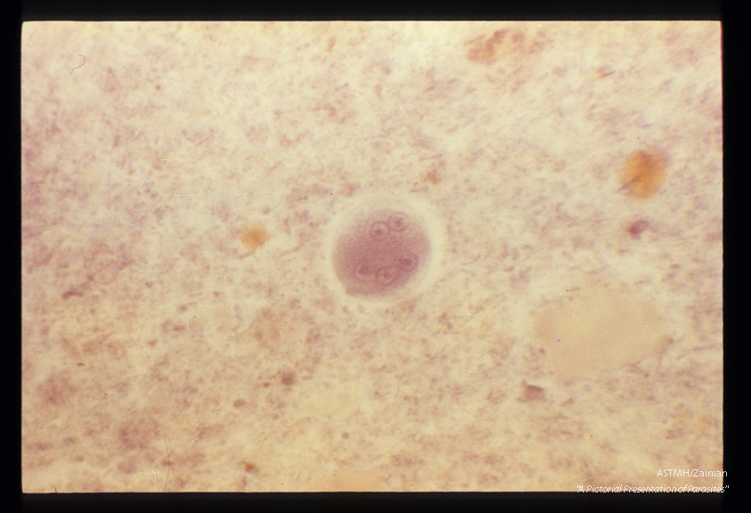 Cysts in stool, showing various numbers of nuclei, hematoxylin stain.