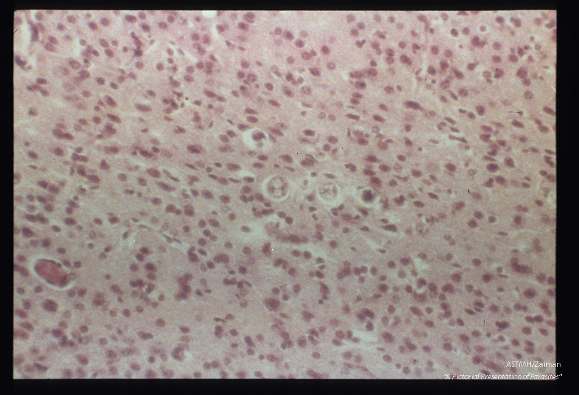 Hematoxylin-eosin stained sections of infected mouse brain.