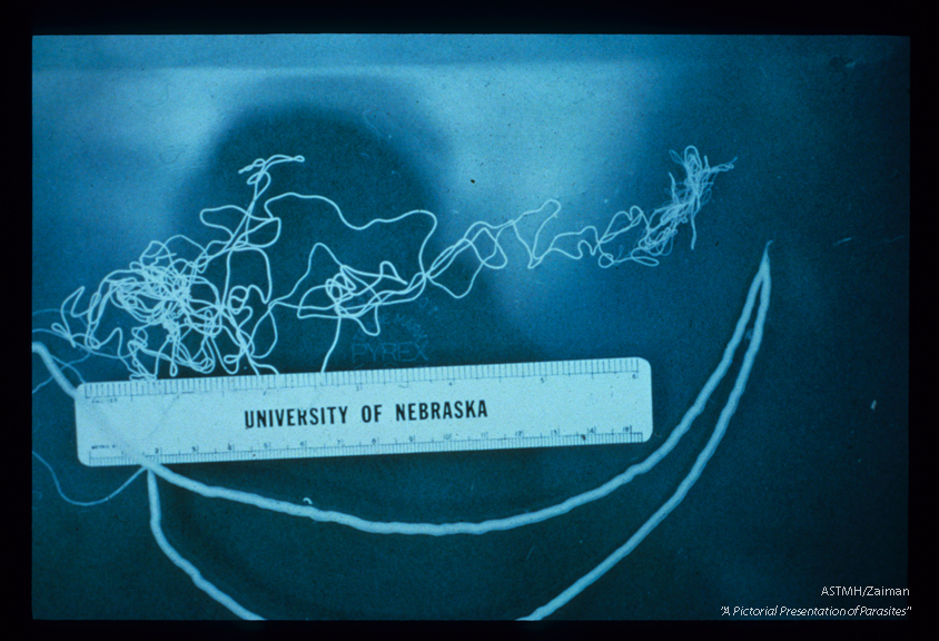 Female reproductive system. The system is essentially composed of two tubes which fuse to form a single vagina. Specific sections function as ovaries, oviducts and uteri. Compare with slide number 43, which shows the female in cross section.