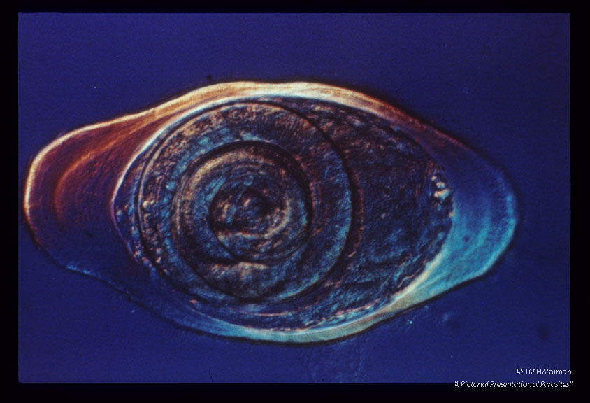 Nurse cell with larva. Nomarski optics.