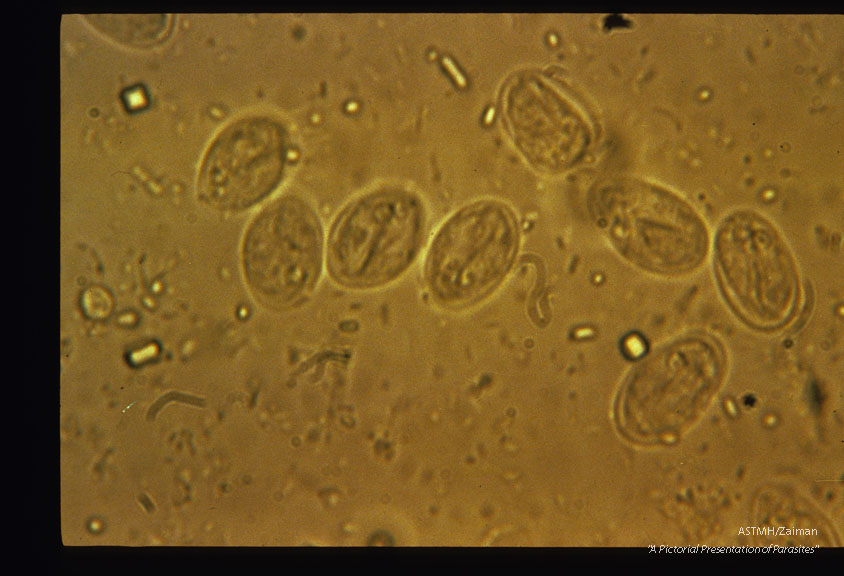 Stool smear. Unstained cysts.