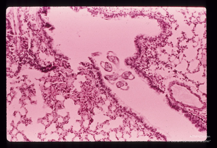 Larvae in guinea pig bronchus.