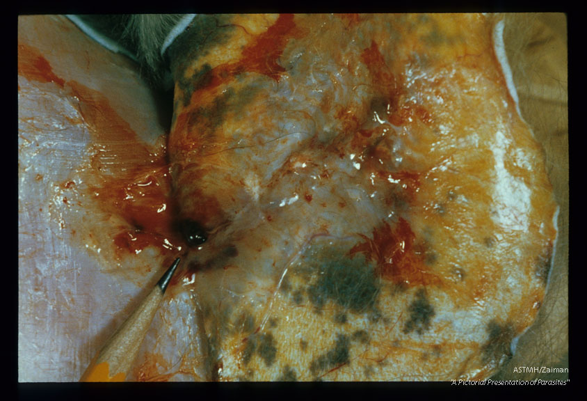 Multiple hemorrhages caused by young (20 days old) worms migrating between the skin and abdominal musculature.