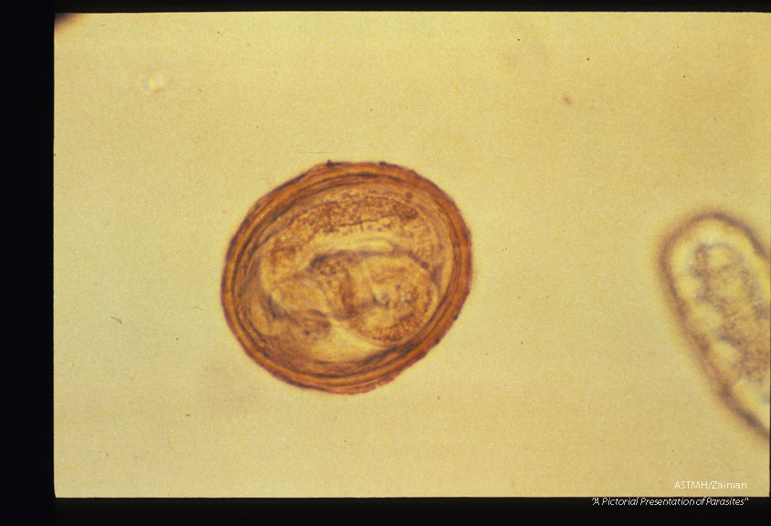 Infective egg from soil.