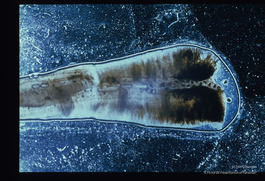 Metacercariae present as a line of clear cysts with dark centers which are the intestines of the metacercariae.