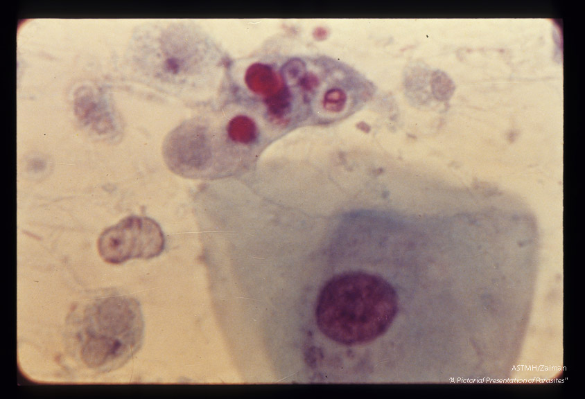 Trophozoite among epithelial cells. Trichrome stain.