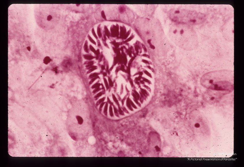 Mature first-generation schizont 72 hours after inoculation. H & E stain.