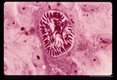 Mature first-generation schizont 72 hours after inoculation. H & E stain.