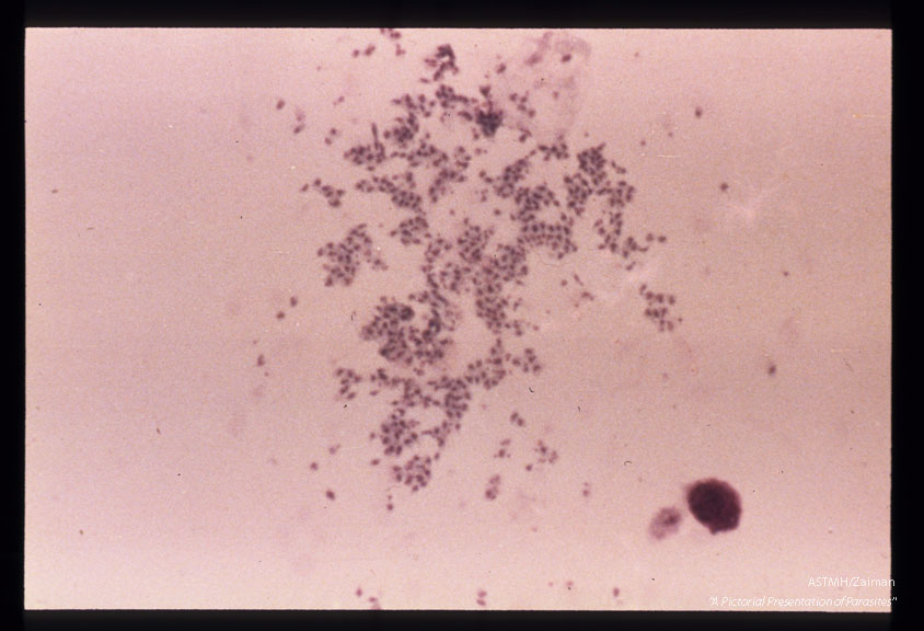 Ruptured Hela cell infected with Peru strain.