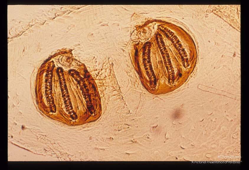 Maggot posterior spiracle.