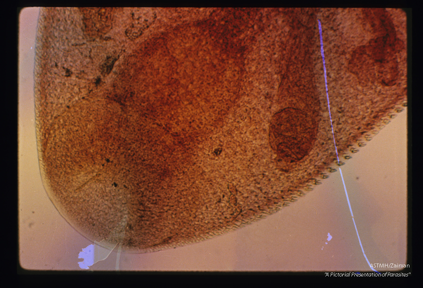 Higher power view of the anterior portion of the parasite in slide 57. This was taken to demonstrate the cuticular spines which help differentiate this parasite from Clonorchis when sections of infected bile ducts must be examined.