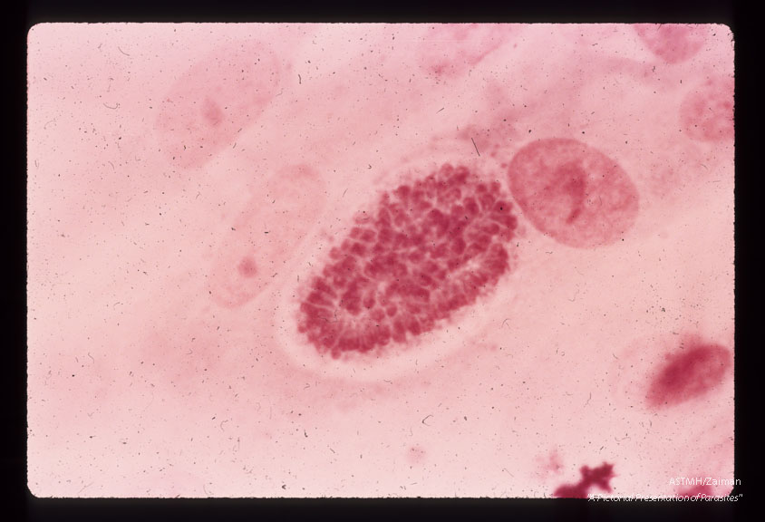 Incompletely segmented first-generation schizont. Nuclei of the forming merozoitea are clearly visible. Giemsa's stain. (58 hr).