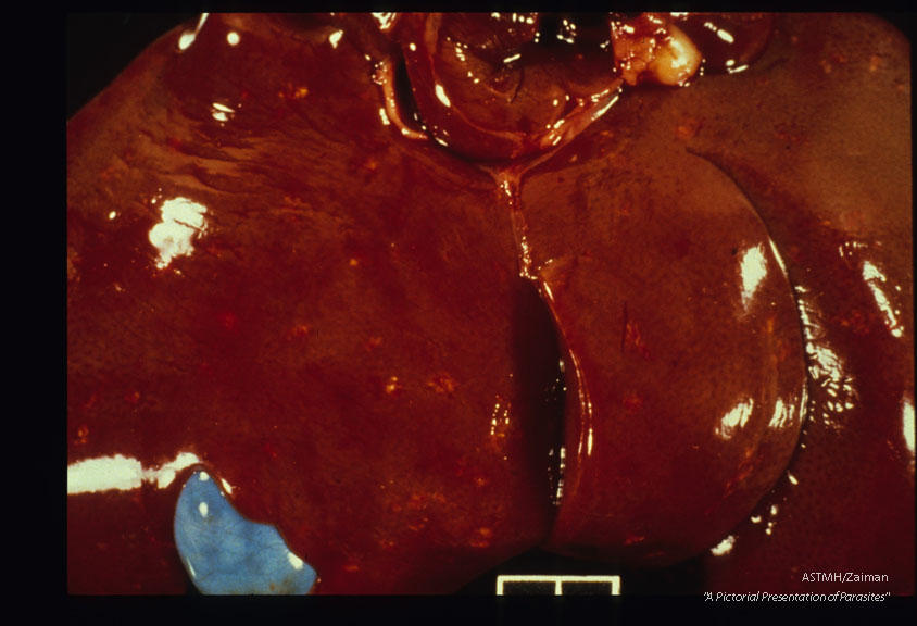 Experimental cat infection. Five thousand infective eggs given. Numerous granulomas are present in the liver parenchyme 25 days after infection.