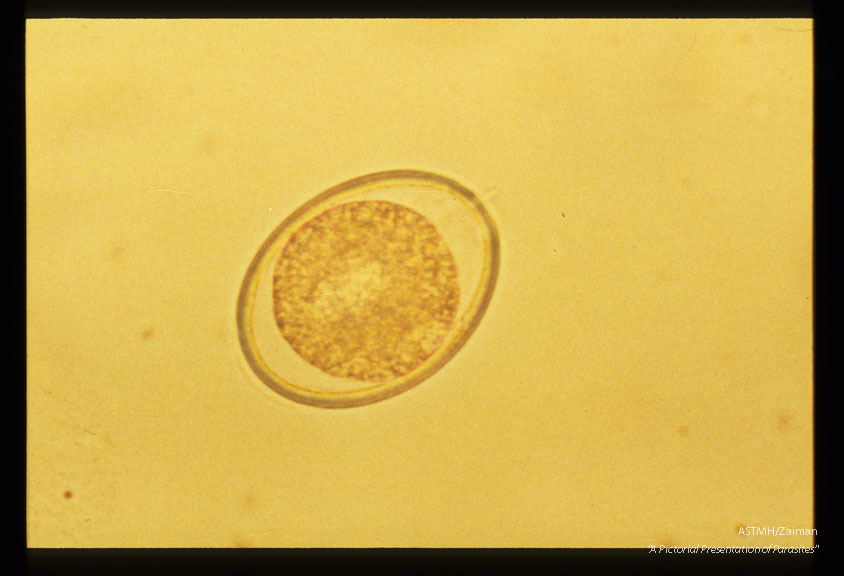 Development and hatching of larva.