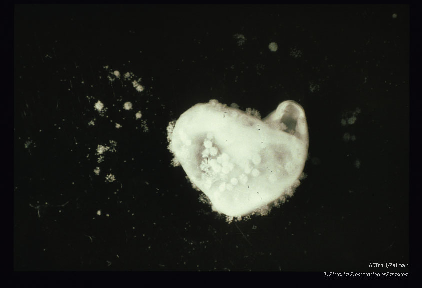 Lining of a cyst s-howing multiple brood capsules containing protoscolices.