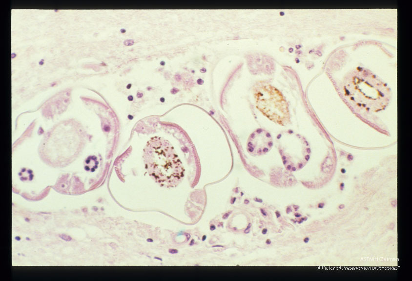 Longitudinal and cross-section of larvae in the spinal cord.