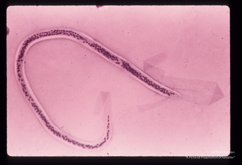 Entire microfilaria in blood film.