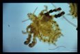 Crab lice have a relatively narrow head, a broad thorax and crab-like claws. Respiratory spiracles and trachea are clearly shown.