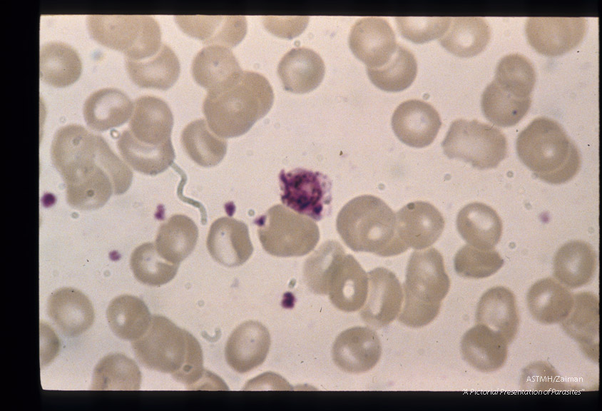 The development of male sexual cells from gametocyte to sperm cells (exflagellation) is shown in this series.