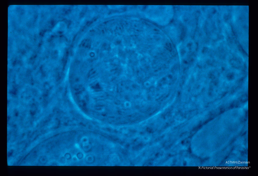 A parasite of wild turkeys. Oocysts on the midgut of the mosquito, Culex pipiens pipiens.