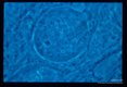 A parasite of wild turkeys. Oocysts on the midgut of the mosquito, Culex pipiens pipiens.