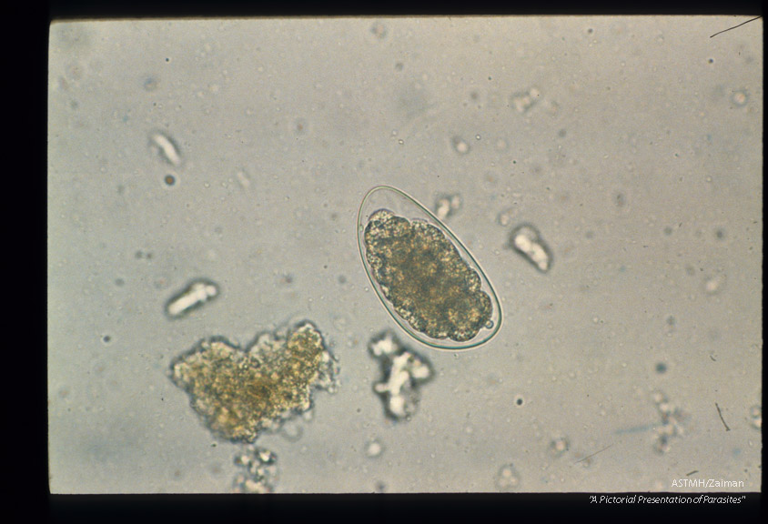 Egg from human stool. Characteristically this egg is longer than hookworm eggs.