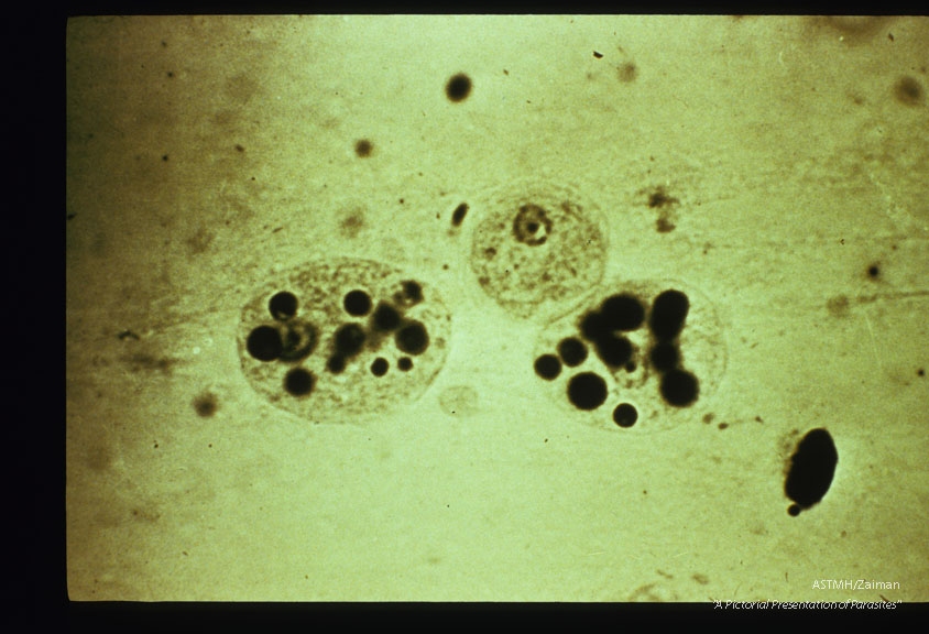 Haematoxylin stained hematophagous trophozoite.