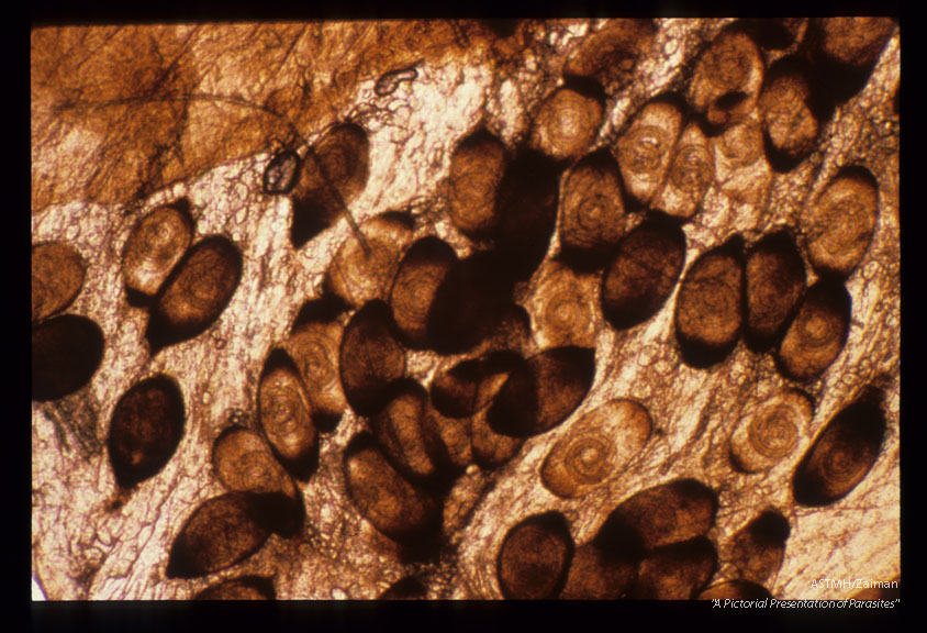 Various magnifications of calcified cysts in masseter muscle of rat xeroradiographed in slide 1602.