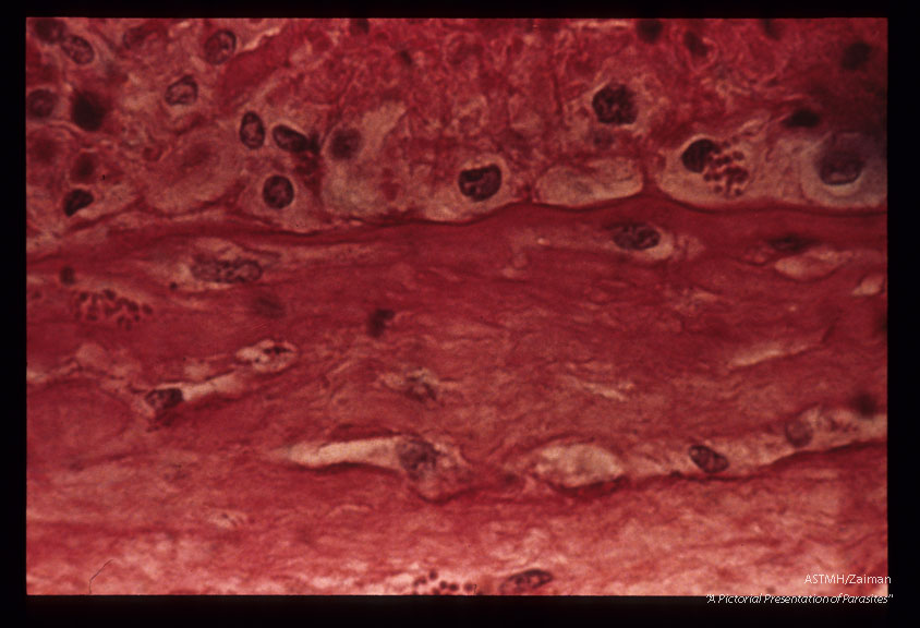 Two groups in chorion, one in the decidua of a human placenta . H&E stain.